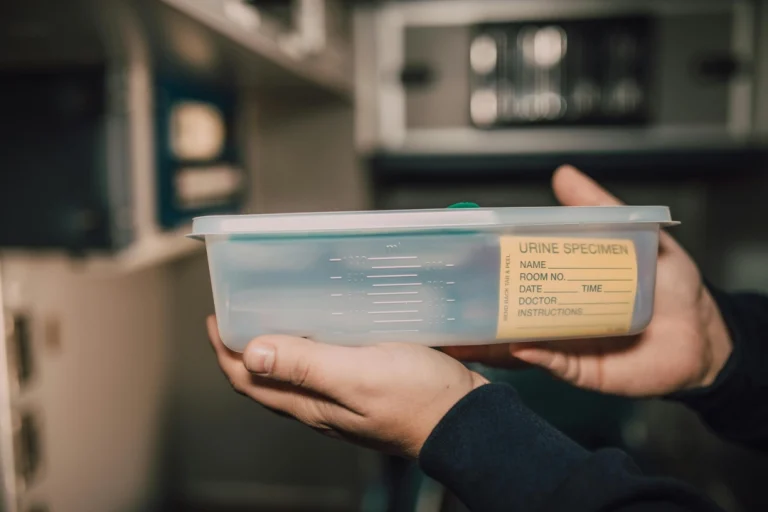 Specimen container for testing required to complete your FMCSA-compliant dot physical houston tx.