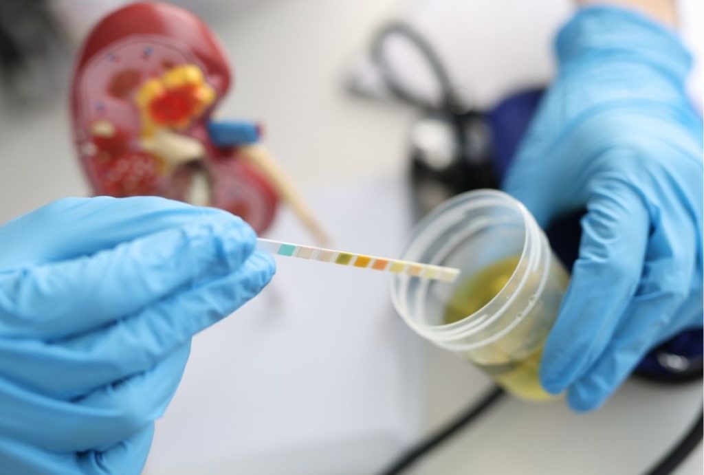 Medical professional conducts urinalysis with test strip and sample during CDL Physical Houston health screening.
