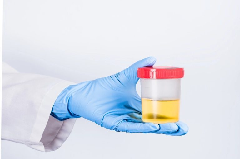 Gloved clinician holding sealed urine sample for laboratory screening, part of compliance testing — DOT Physical Exam Houston