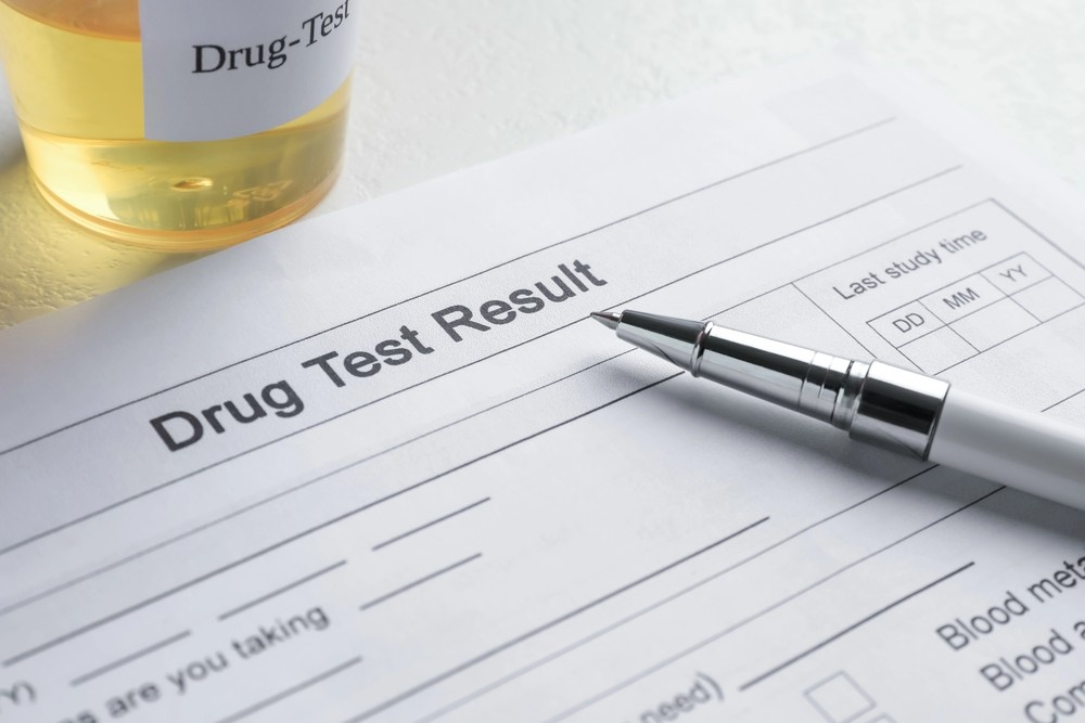 Urine drug test result form with sample container, required screening for commercial drivers — DOT Physical Exam Houston