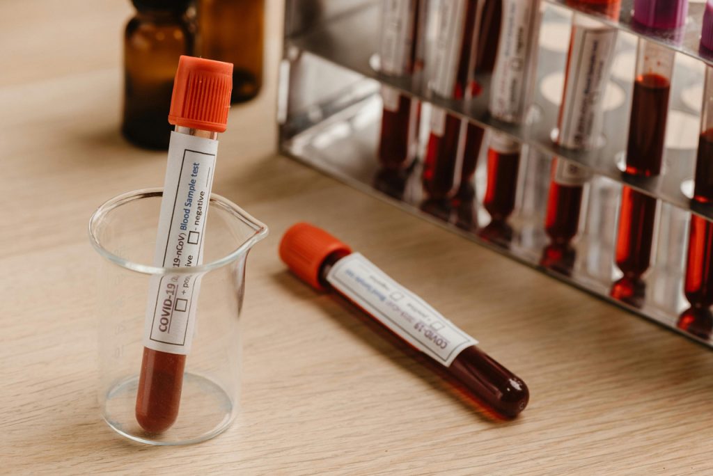 Lab technician preparing blood samples for a DOT drug test Houston procedure at a professional medical facility.