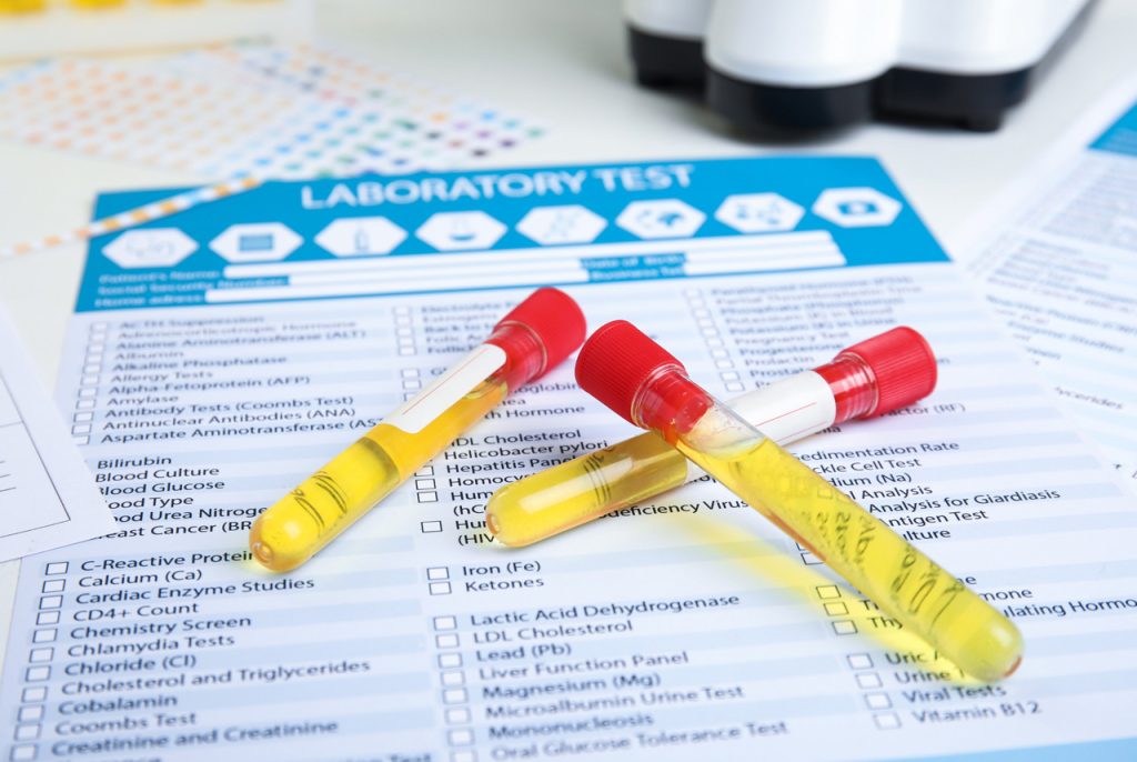 Medical laboratory test vials and screening paperwork for a DOT drug test Houston employee compliance evaluation.