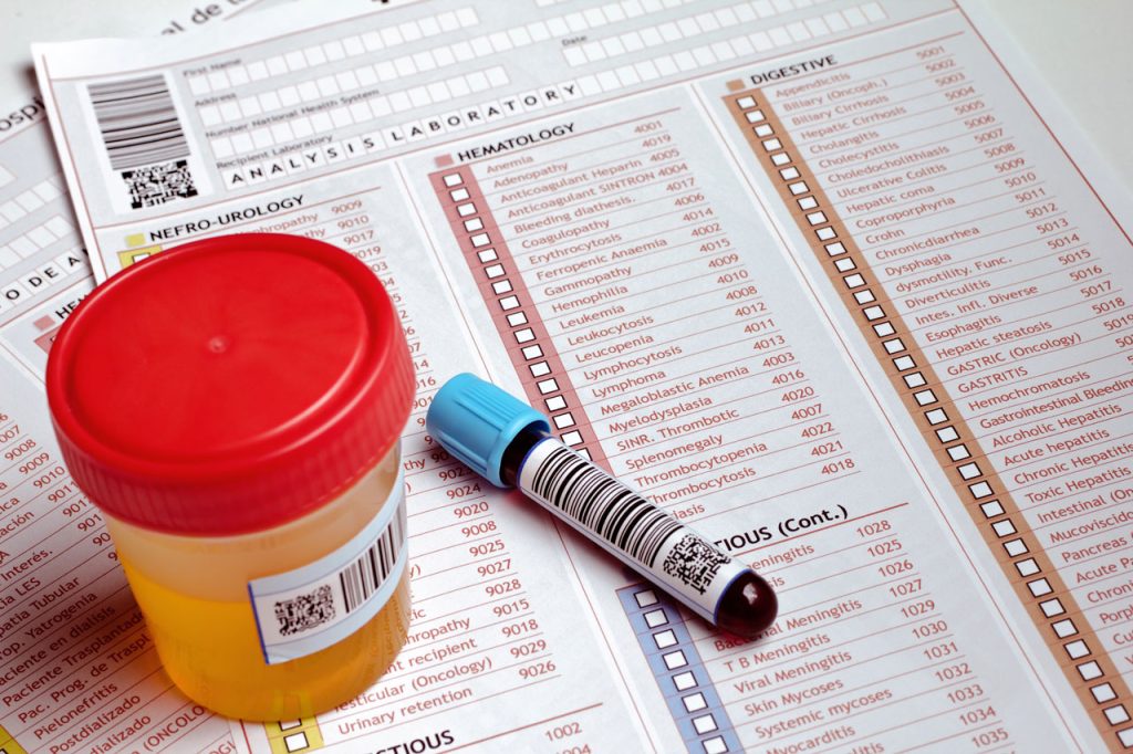 Lab forms for a DOT drug test Houston with urine and blood specimen vials prepared for clinical analysis and review.
