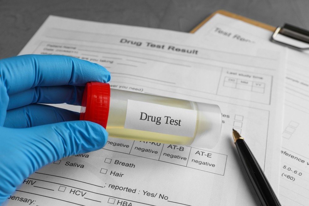 A gloved hand holds a urine sample container over official Dot drug test houston paperwork at a testing center.