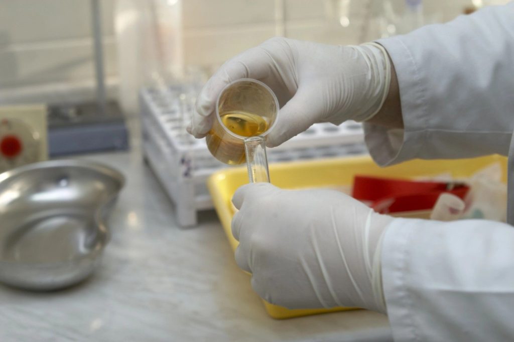 Medical professional conducting a DOT drug test Houston laboratory screening with a commercial urine specimen. 