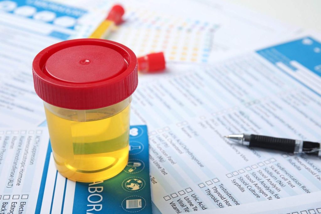 A sealed urine sample cup resting on forms, required for a commercial DOT drug test Houston workplace screening. 